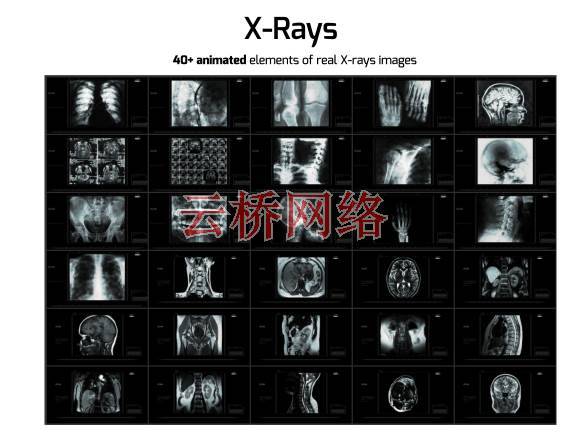 700种医疗生物科学人体骨骼器官DNA细胞动画元素 AtomX 破解版 AE软件插件-第5张